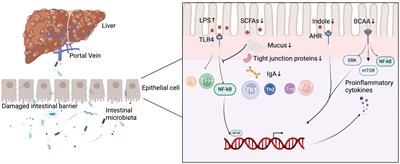 The significance of gut microbiota in the etiology of autoimmune hepatitis: a narrative review